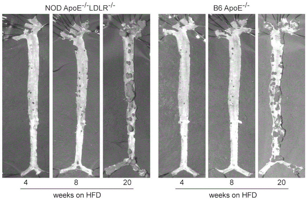 一种NOD遗传背景的动脉粥样硬化小鼠模型的制备方法