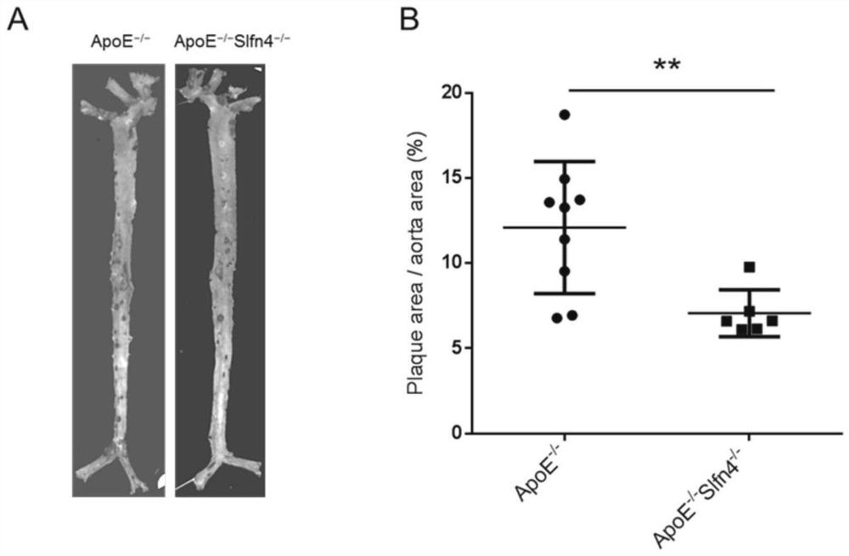 一种Slfn4缺失的动脉粥样硬化模型小鼠的构建方法及其应用