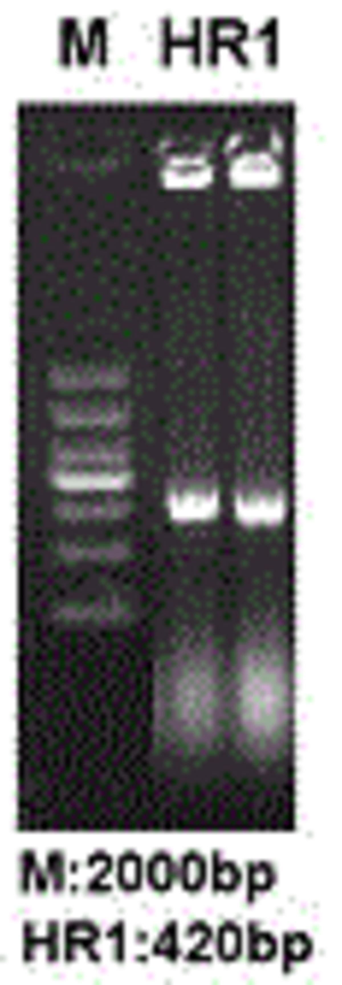 一种长链非编码RNA lnc‑HR1用途及克隆方法